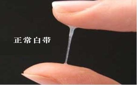 白带异常
