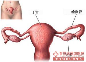 输卵管不孕的治疗方法