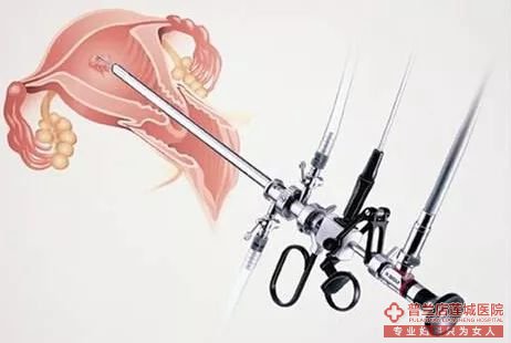 大连金州玛丽亚妇科医院微创妇科
