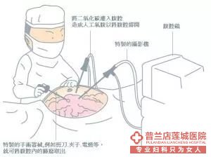 大连金州玛丽亚妇科医院微创妇科
