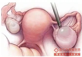 大连金州玛丽亚妇科医院：您了解“女性最烦的”疾病是什么吗？