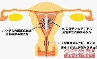 大连金州玛丽亚妇科医院专家告诉你是选择“节育”还是“结扎”！